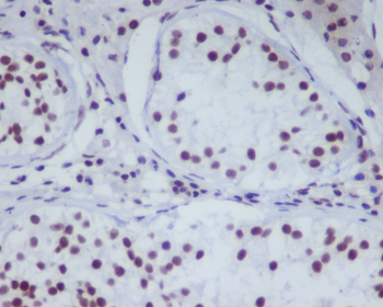 HDAC1 Rabbit mAb [KD Validated]