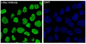 c-Myc Rabbit mAb Antibody
