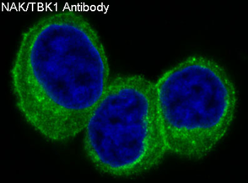 NAK/TBK1 (N-term) Rabbit mAb Antibody