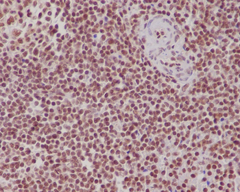 FUBP1 Rabbit mAb Antibody