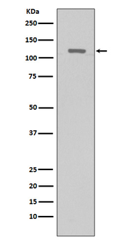 TERT Rabbit Monoclonal Antibody
