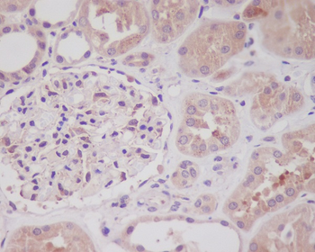 Nrf2 Rabbit mAb Antibody