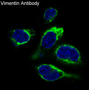 Vimentin Rabbit mAb Antibody