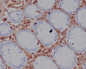 Vimentin Rabbit mAb Antibody