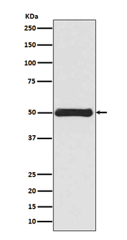 Vimentin Rabbit mAb Antibody