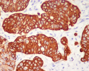 Cytokeratin 5 (C-term) Rabbit mAb Antibody