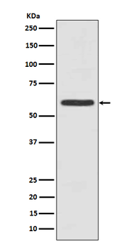 Cytokeratin 5 (C-term) Rabbit mAb Antibody