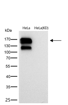 Integrin beta 1 Rabbit mAb [KD Validated] Antibody