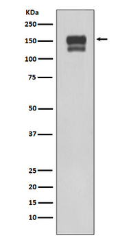 Integrin beta 1 Rabbit mAb [KD Validated]