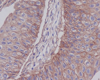 Integrin beta 1 Rabbit mAb [KD Validated]