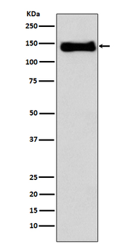 Integrin beta 1 Rabbit mAb [KD Validated]