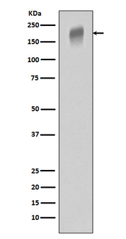 VEGF Receptor 1 Rabbit mAb