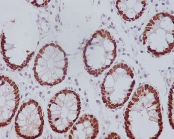 CDX2 Rabbit mAb Antibody
