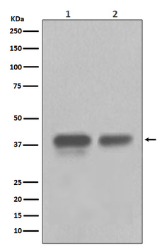CDX2 Rabbit mAb Antibody