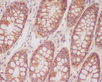 CD46 Rabbit mAb Antibody