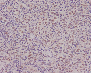 PMS2 Rabbit mAb Antibody