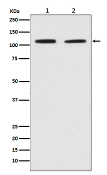 PMS2 Rabbit mAb