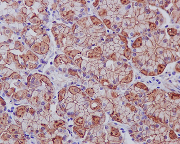 EGFR (ErbB 1) Rabbit mAb [KD Validated]