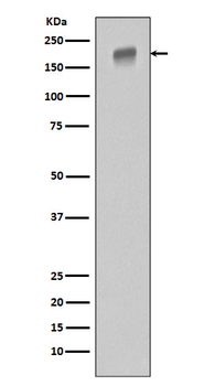 EGFR (ErbB 1) Rabbit mAb [KD Validated]