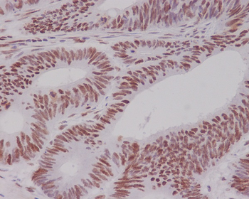 MSH6 Rabbit mAb Antibody