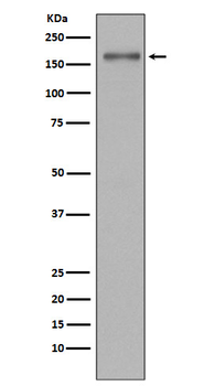 MSH6 Rabbit mAb Antibody