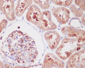 ARG1 Rabbit Monoclonal Antibody
