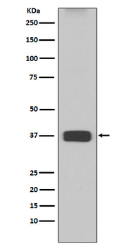 ARG1 Rabbit Monoclonal Antibody