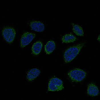 Smad2 Rabbit mAb Antibody