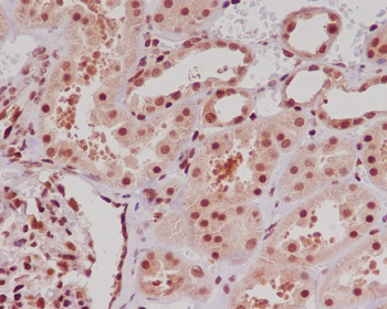 ERG Rabbit mAb Antibody
