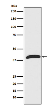 ERK1 Rabbit mAb [KD Validated]