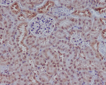 Rad51 Rabbit mAb [KD Validated]