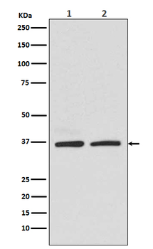 Rad51 Rabbit mAb [KD Validated]