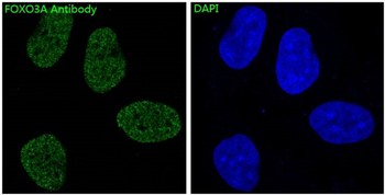 FoxO3a Rabbit mAb Antibody