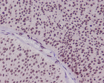 FoxO3a Rabbit mAb Antibody