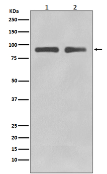 FoxO3a Rabbit mAb Antibody