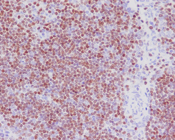 SATB1 Rabbit mAb Antibody