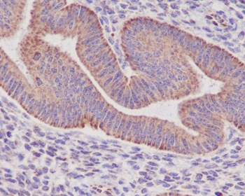 Sonic Hedgehog Rabbit mAb Antibody