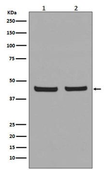 PHD1/prolyl hydroxylase Rabbit mAb Antibody