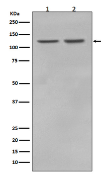 RNF20 Rabbit mAb Antibody