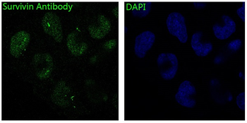 Survivin Rabbit mAb