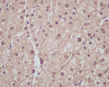 Liver Arginase Rabbit mAb Antibody