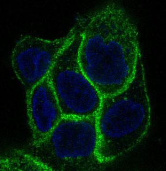 EGFR Rabbit mAb [KD Validated]