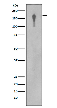 EGFR Rabbit mAb [KD Validated]