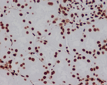HMGB1 Rabbit mAb Antibody
