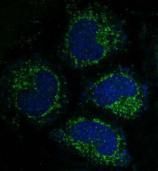 Caspase-3 Rabbit mAb [KD Validated]