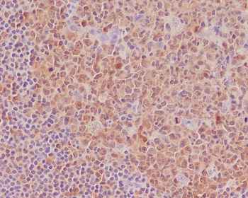 Caspase-3 Rabbit mAb [KD Validated]