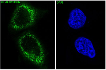 Bcl-XL Rabbit mAb [KD Validated]