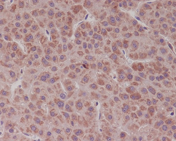Bcl-XL Rabbit mAb [KD Validated]