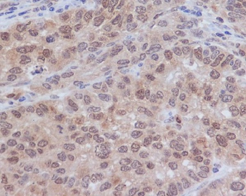 ERK2 Rabbit mAb Antibody