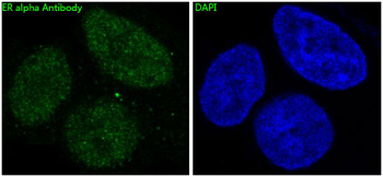 ER alpha Rabbit mAb Antibody